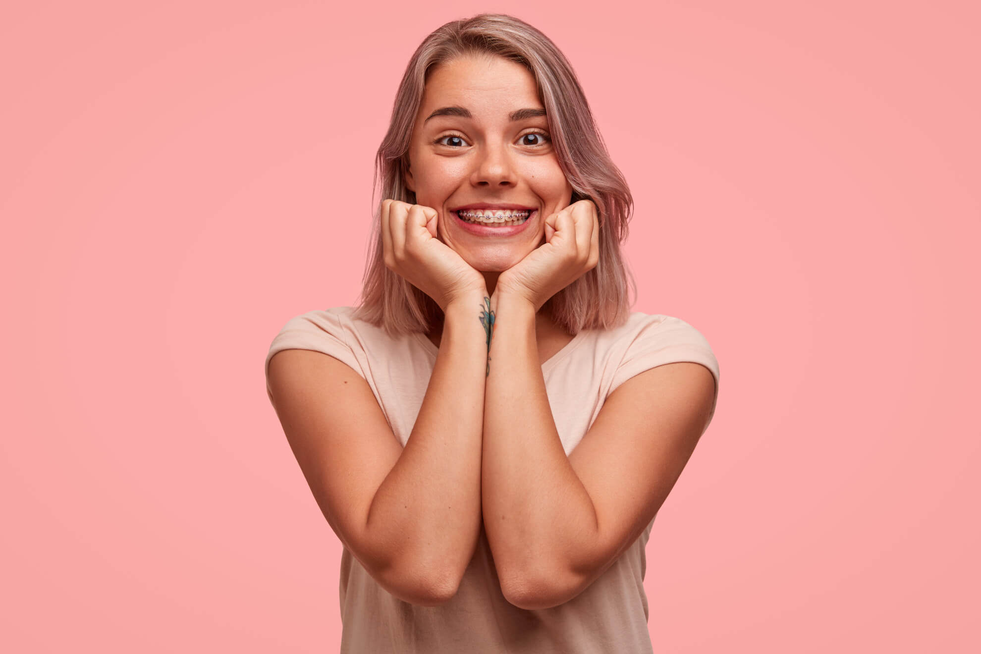 Jenis-Jenis Kawat Gigi (Orthodonti)